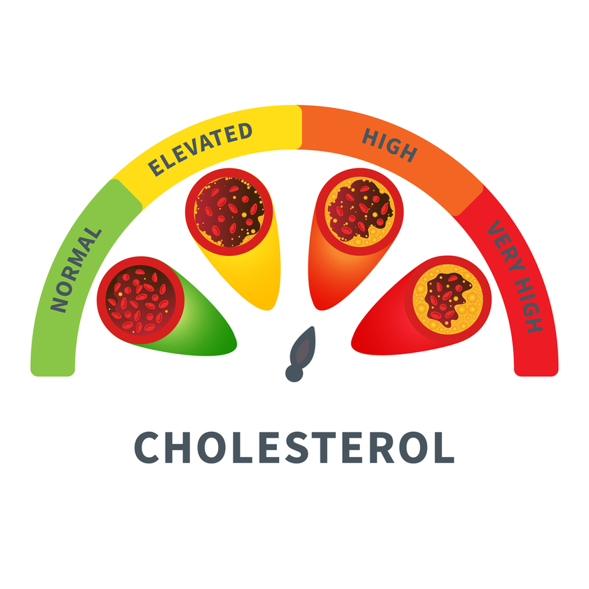 Managing Your Cholesterol Level 5 Lifestyle Changes to Adopt Seaton